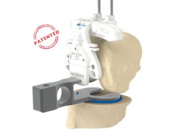 MyKnee LBS: image from Medacta